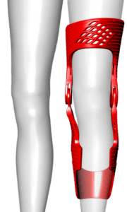 Provoke™ PCL/CI 3D Printed Custom Knee Brace | Osskin